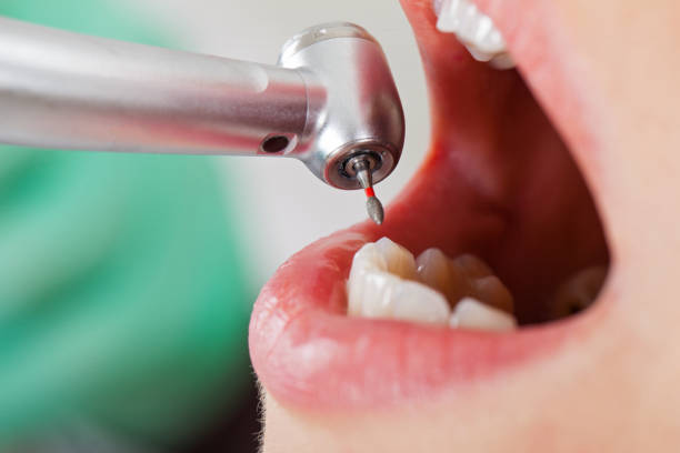 Best Emergency Dental Care for Sports Injuries in Shenandoah, IA